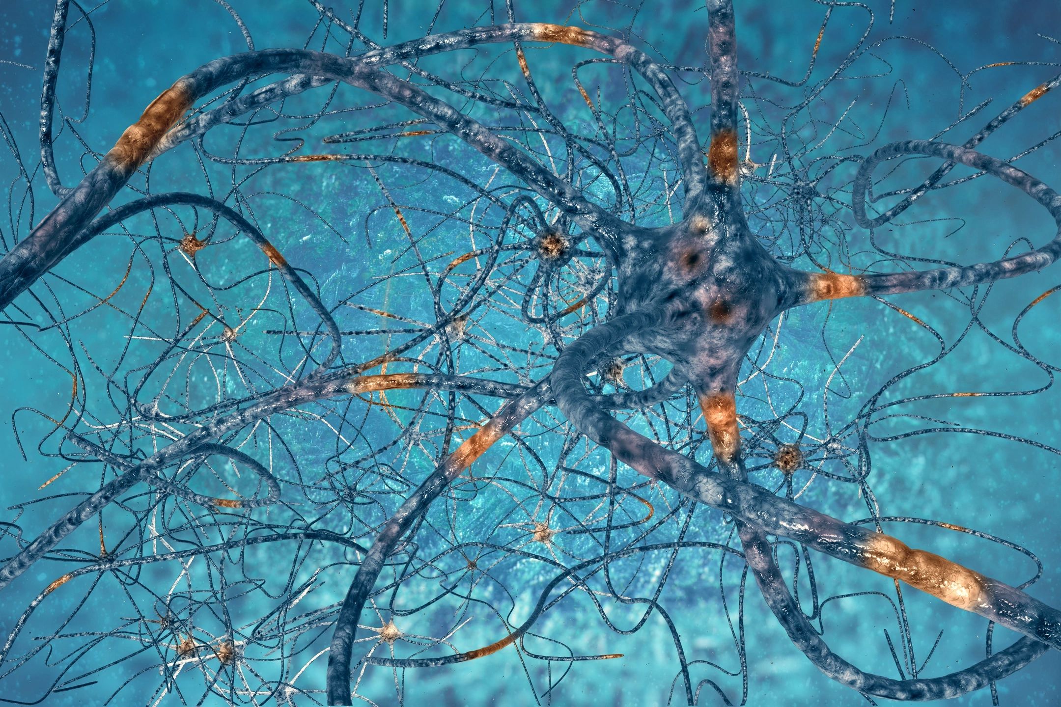 A neuron is shown in the middle of its cell.